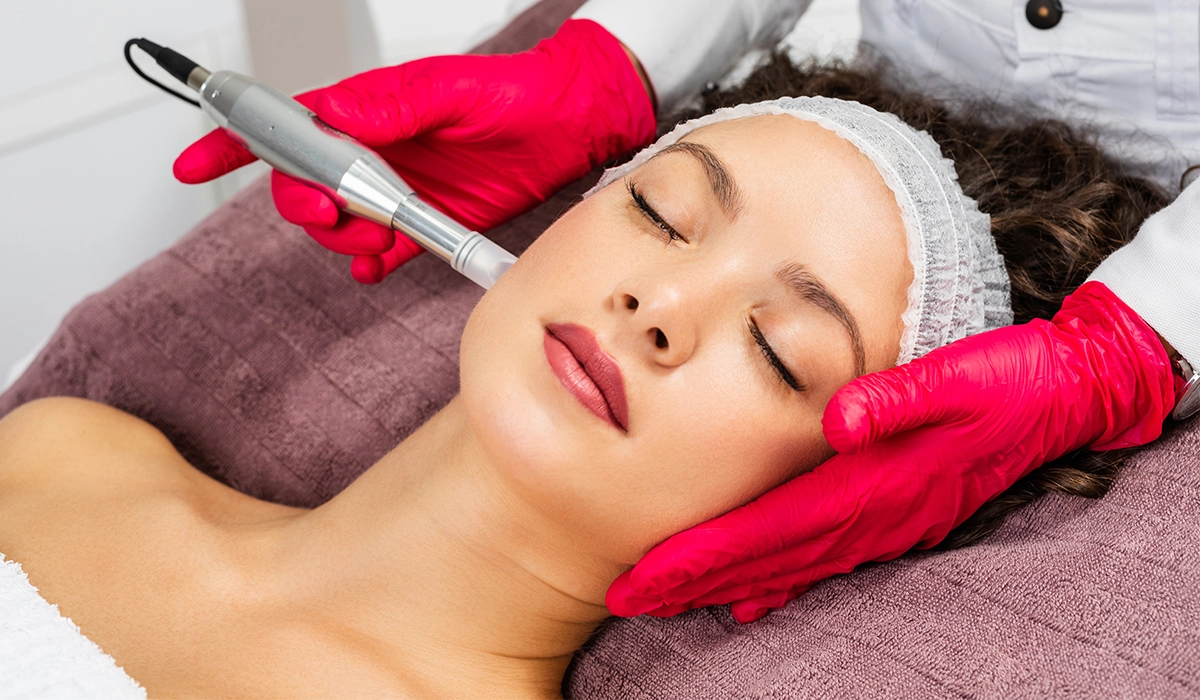 Microneedling